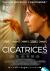 Cicatrices